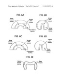 Graded glass/ceramic/glass structures for damage resistant ceramic dental and orthopedic prostheses diagram and image