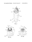 Force redirecting dental core system diagram and image