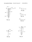 Force redirecting dental core system diagram and image