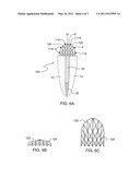 Force redirecting dental core system diagram and image