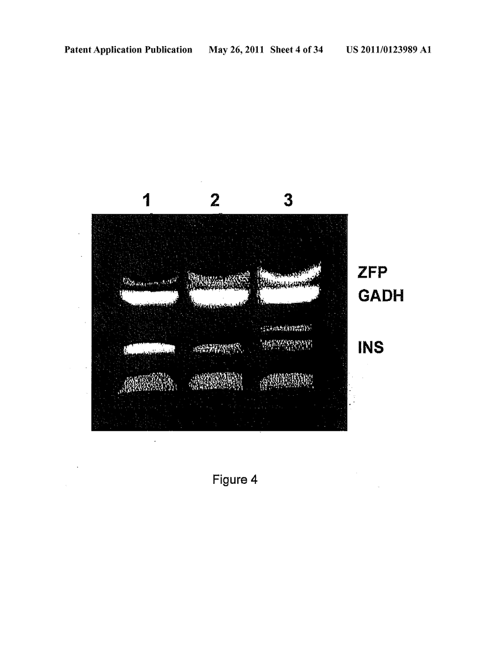 METHOD FOR THE DETECTION OF SCHIZOPHRENIA RELATED GENE TRANSCRIPTS IN BLOOD - diagram, schematic, and image 05