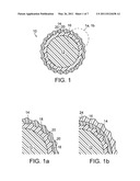 GOLF BALL HAVING VISUALLY ENHANCED NON-UNIFORM THICKNESS INTERMEDIATE LAYER diagram and image