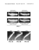 Methods for Bone Treatment by Modulating an Arachidonic Acid Metabolic or Signaling Pathway diagram and image