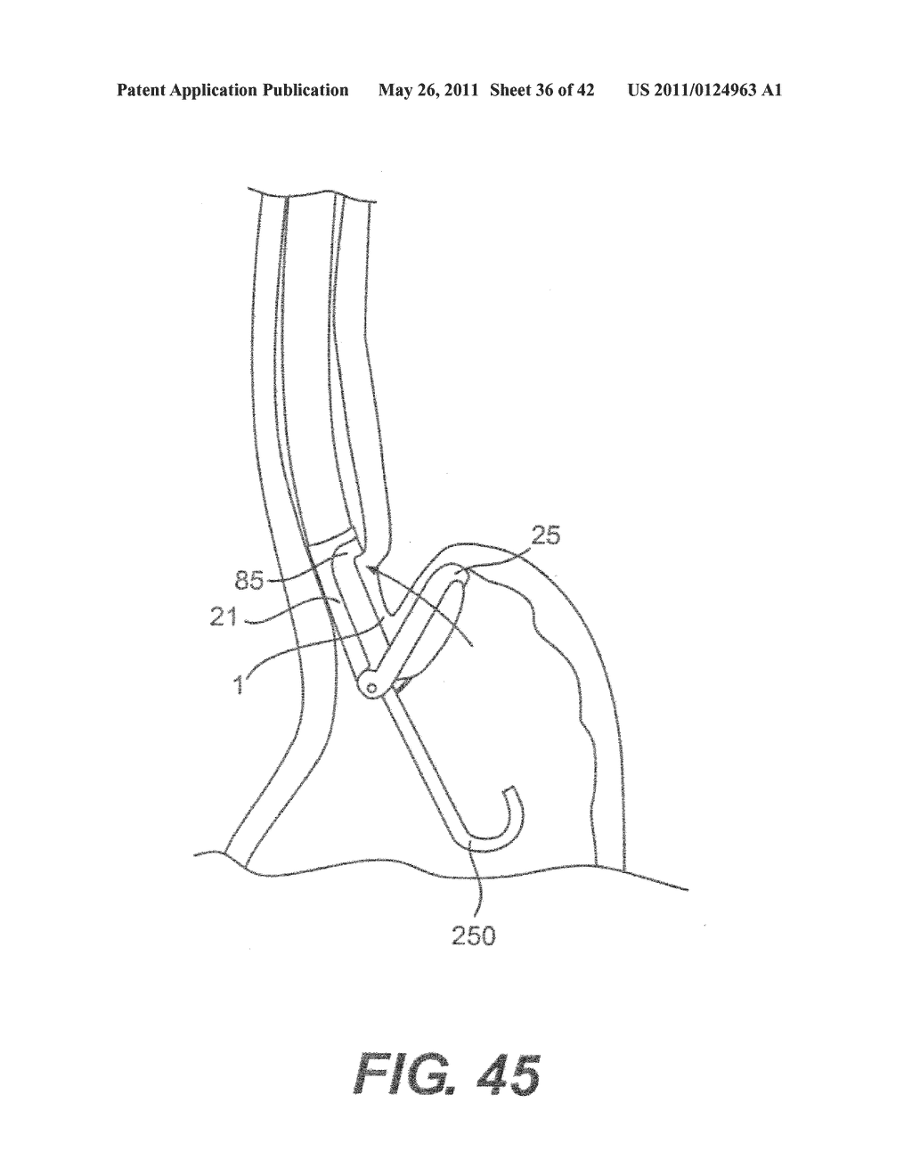 DEVICES AND METHODS FOR FASTENING TISSUE LAYERS - diagram, schematic, and image 37