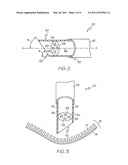 METHODS FOR CLOSING A GASTROTOMY diagram and image