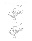 METHODS FOR CLOSING A GASTROTOMY diagram and image