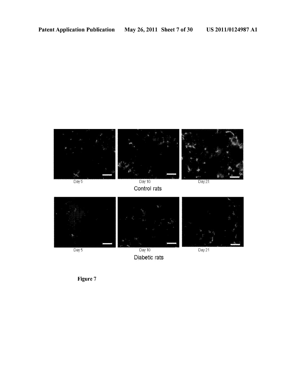 Methods for Measuring Changes in Optical Properties of Wound Tissue and Correlating Near Infrared Absorption (FNIR) and Diffuse Reflectance Spectroscopy Scattering (DRS) With Tissue Neovascularization and Collagen Concentration to Determine Whether Wound is Healing - diagram, schematic, and image 08