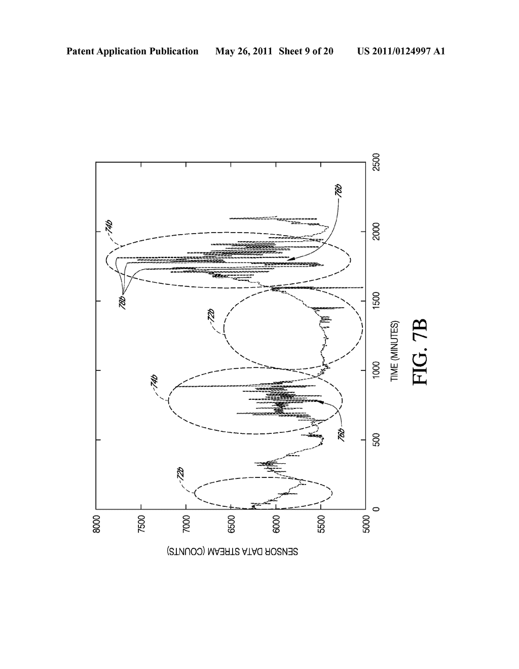 SYSTEM AND METHODS FOR REPLACING SIGNAL ARTIFACTS IN A GLUCOSE SENSOR DATA STREAM - diagram, schematic, and image 10