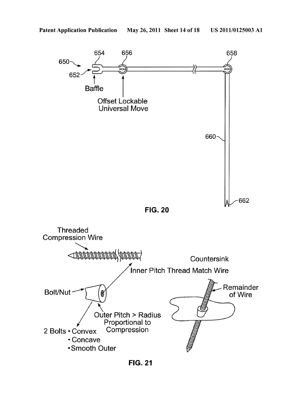 Systems, Devices and Methods For Cartilage and Bone Grafting - diagram, schematic, and image 15