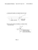 SURGERY ASSISTANCE SYSTEM diagram and image