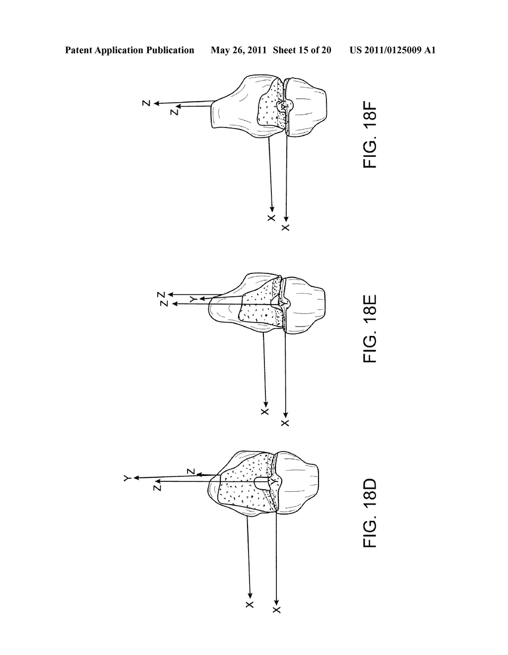 Assessing the Condition of a Joint and Devising Treatment - diagram, schematic, and image 16