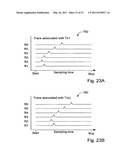 Systems and Methods for Ultrasound Imaging diagram and image