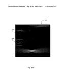 Systems and Methods for Ultrasound Imaging diagram and image