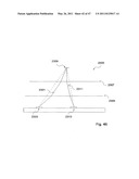 Systems and Methods for Ultrasound Imaging diagram and image