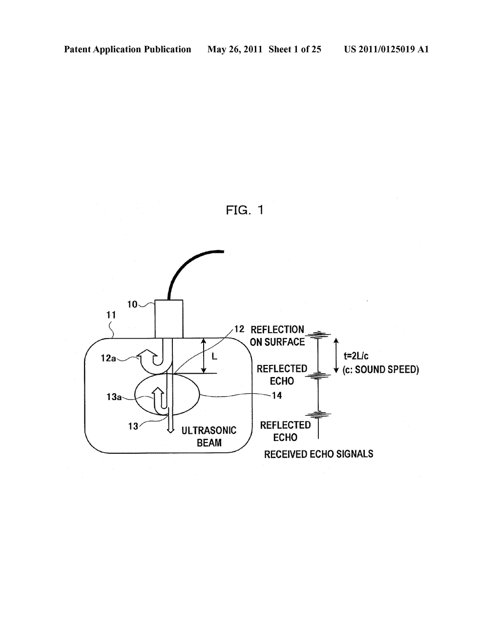 ULTRASONIC DIAGNOSIS SYSTEM AND DISTORTION DISTRIBUTION DISPLAY METHOD - diagram, schematic, and image 02