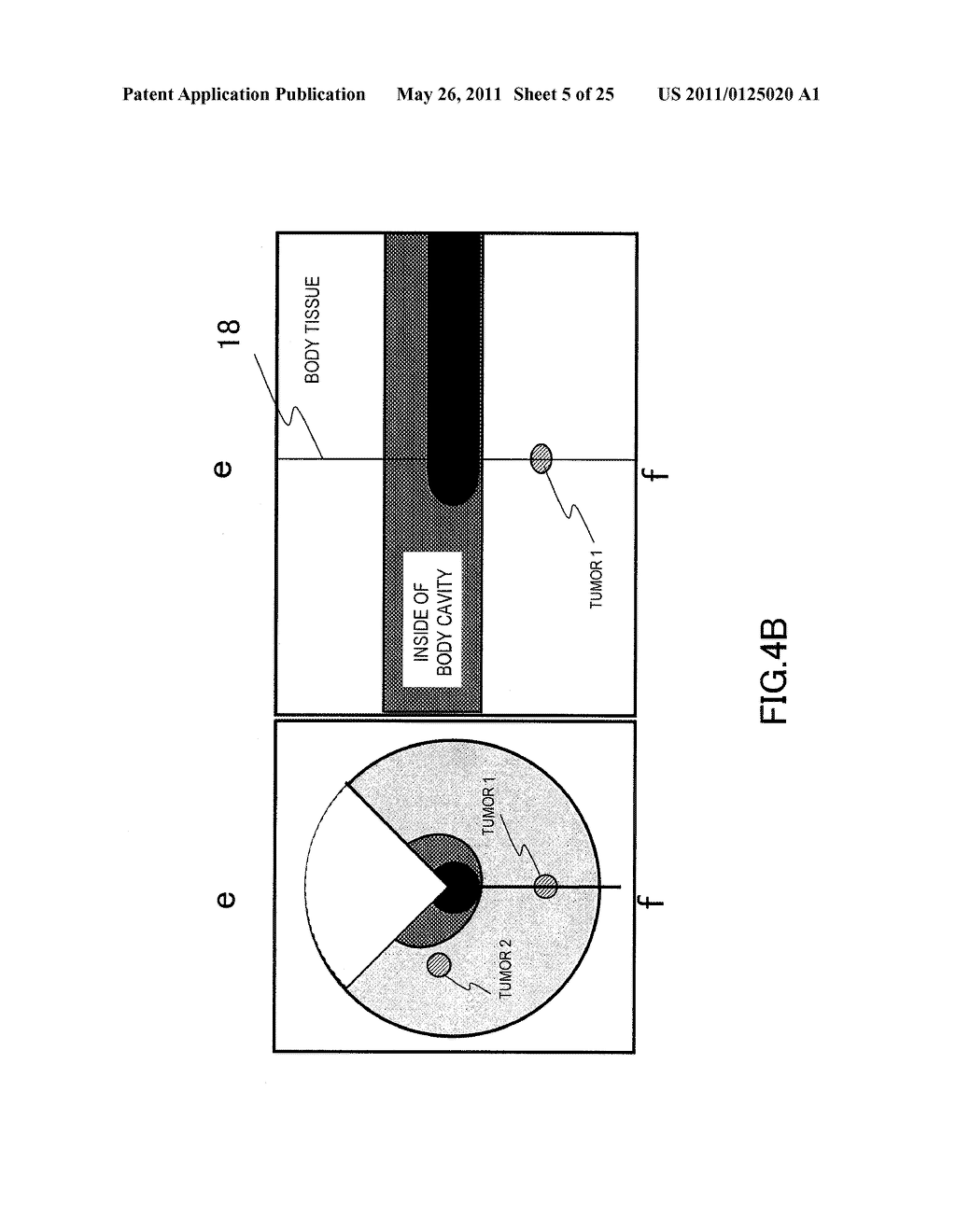 ULTRASONIC DIAGNOSTIC APPARATUS AND METHOD FOR DISPLAYING PROBE OPERATION GUIDE - diagram, schematic, and image 06