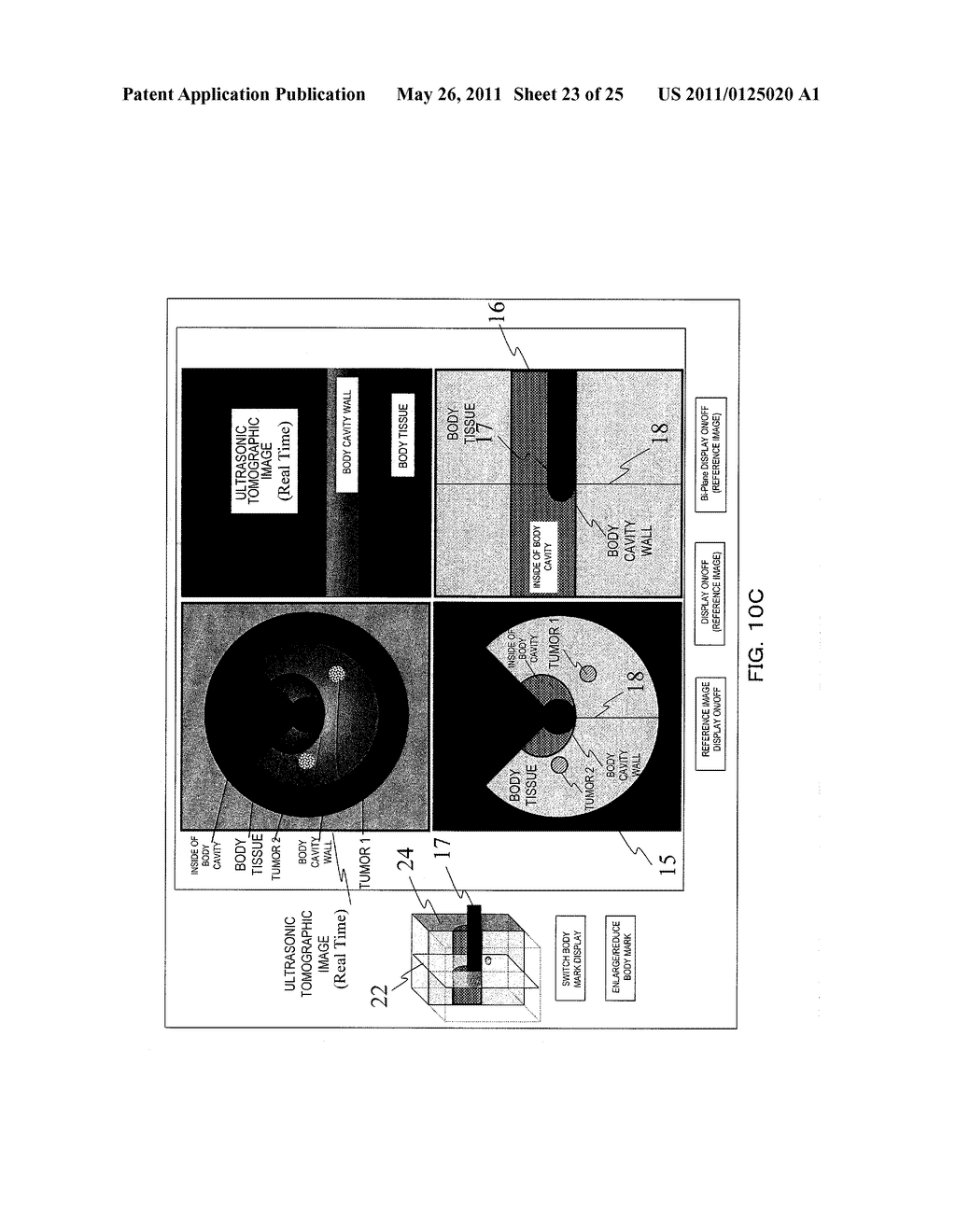 ULTRASONIC DIAGNOSTIC APPARATUS AND METHOD FOR DISPLAYING PROBE OPERATION GUIDE - diagram, schematic, and image 24