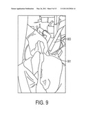 Pharyngeal Ultrasound Guide diagram and image