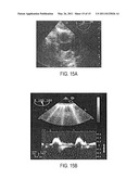 Pharyngeal Ultrasound Guide diagram and image