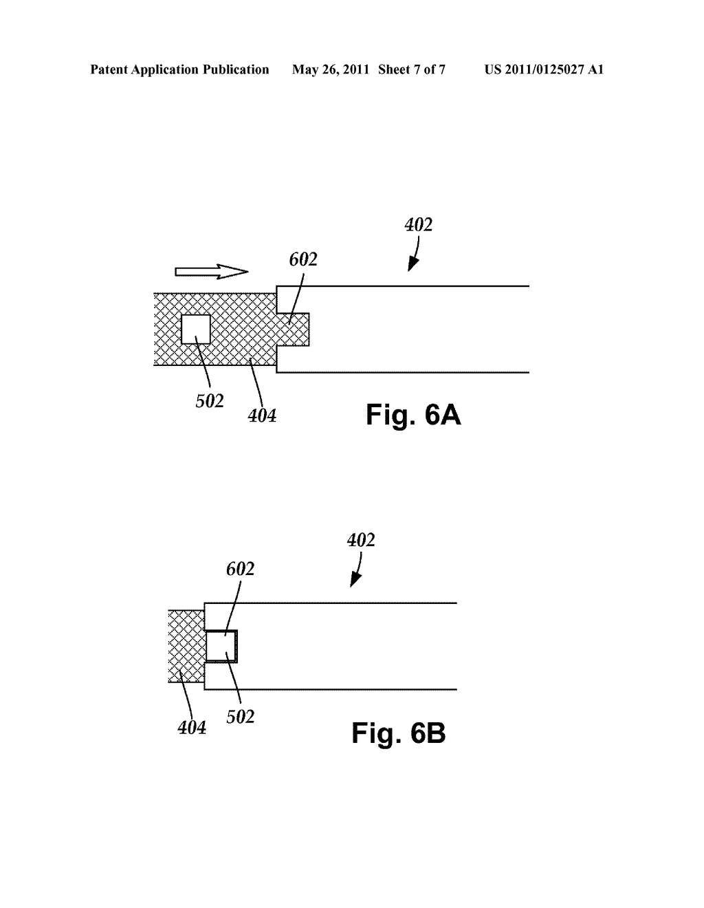 SYSTEMS AND METHODS FOR FLUSHING AIR FROM A CATHETER OF AN INTRAVASCULAR ULTRASOUND IMAGING SYSTEM - diagram, schematic, and image 08