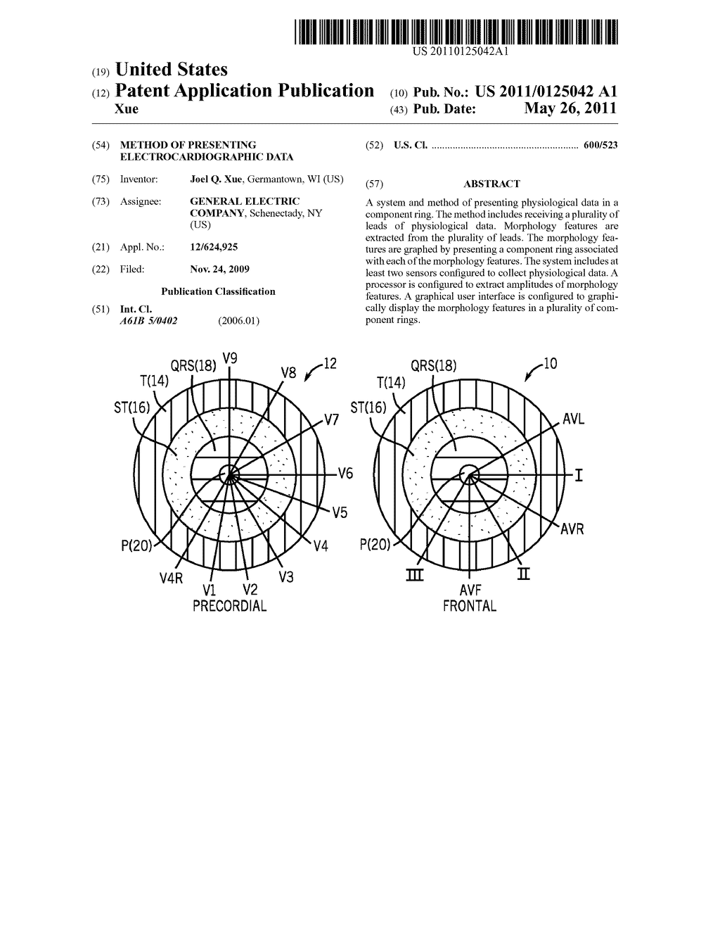 Method of Presenting Electrocardiographic Data - diagram, schematic, and image 01