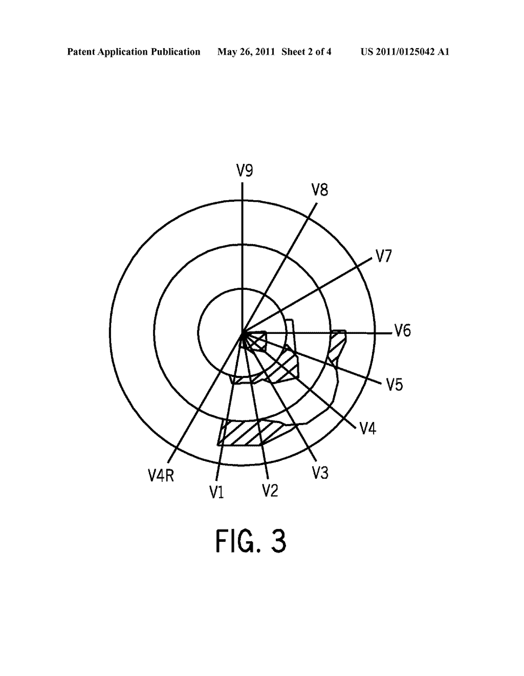 Method of Presenting Electrocardiographic Data - diagram, schematic, and image 03