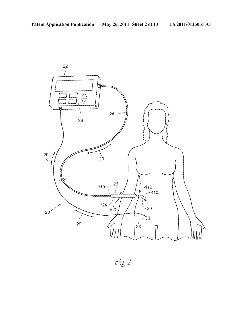 SYSTEMS AND METHODS FOR INTRA-OPERATIVE STIMULATION - diagram, schematic, and image 03