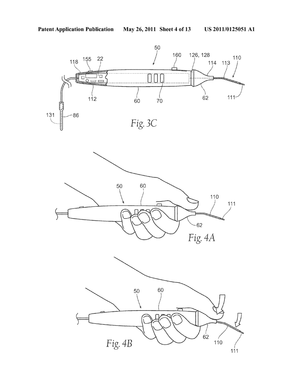 SYSTEMS AND METHODS FOR INTRA-OPERATIVE STIMULATION - diagram, schematic, and image 05