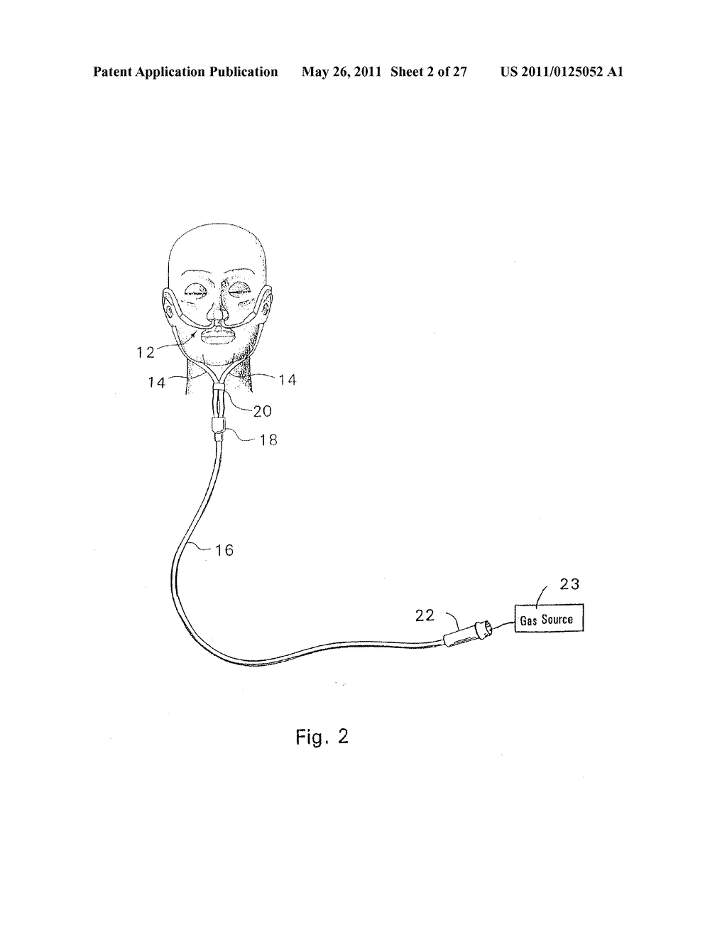 RESPIRATORY THERAPY SYSTEM INCLUDING A NASAL CANNULA ASSEMBLY - diagram, schematic, and image 03