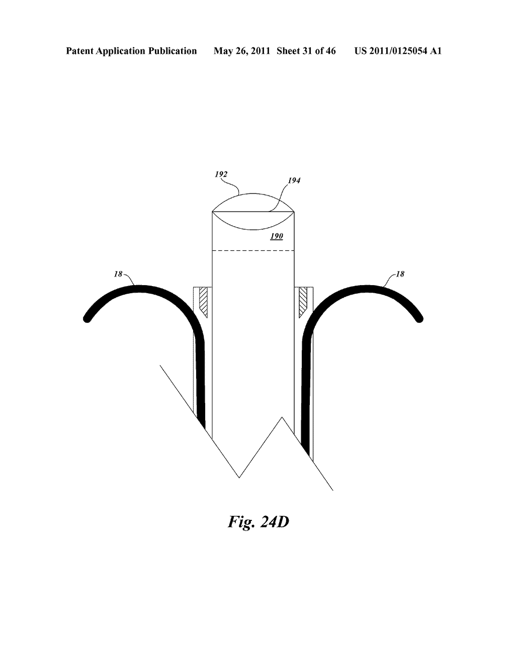 DEVICE, SYSTEM AND METHOD FOR MULTIPLE CORE BIOPSY - diagram, schematic, and image 32