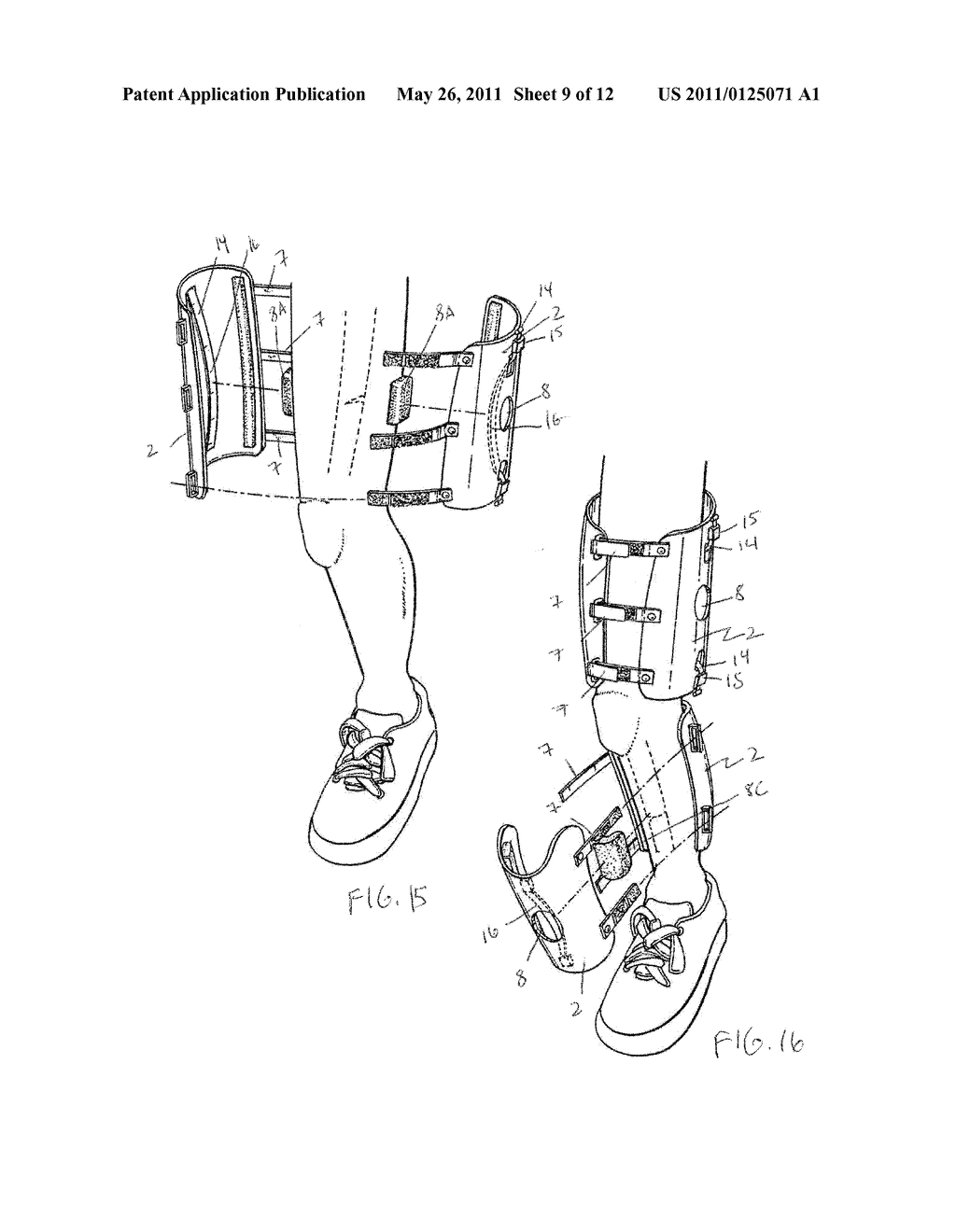 ORTHOPAEDIC DEVICE AND METHOD OF USE FOR TREATING BONE FRACTURES - diagram, schematic, and image 10