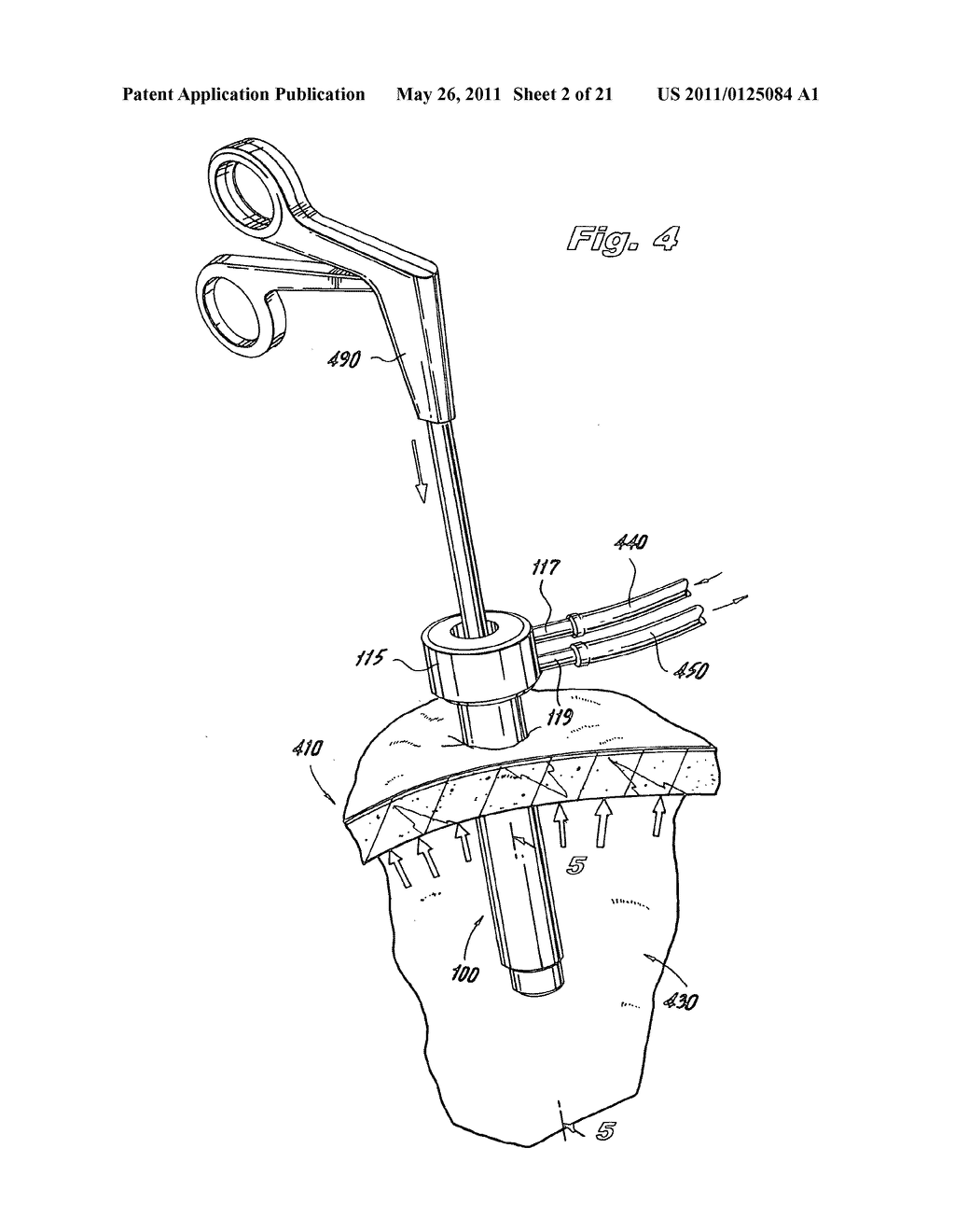 TROCAR ASSEMBLY WITH PNEUMATIC SEALING - diagram, schematic, and image 03