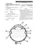 OPHTHALMIC DRUG DELIVERY SYSTEM AND METHOD diagram and image