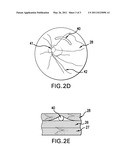 OPHTHALMIC DRUG DELIVERY SYSTEM AND METHOD diagram and image