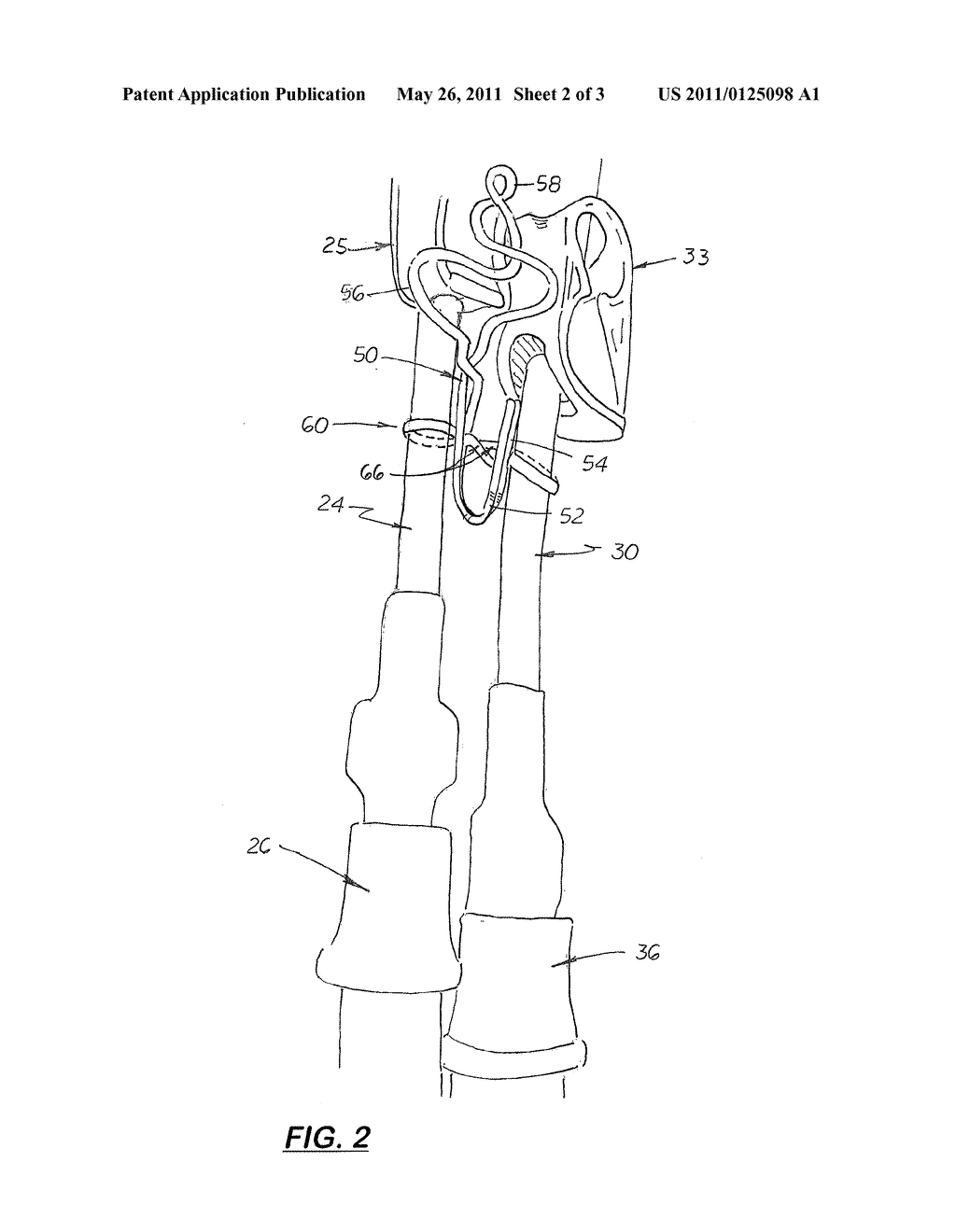 Intravenous Catheter Anchor System and Method - diagram, schematic, and image 03