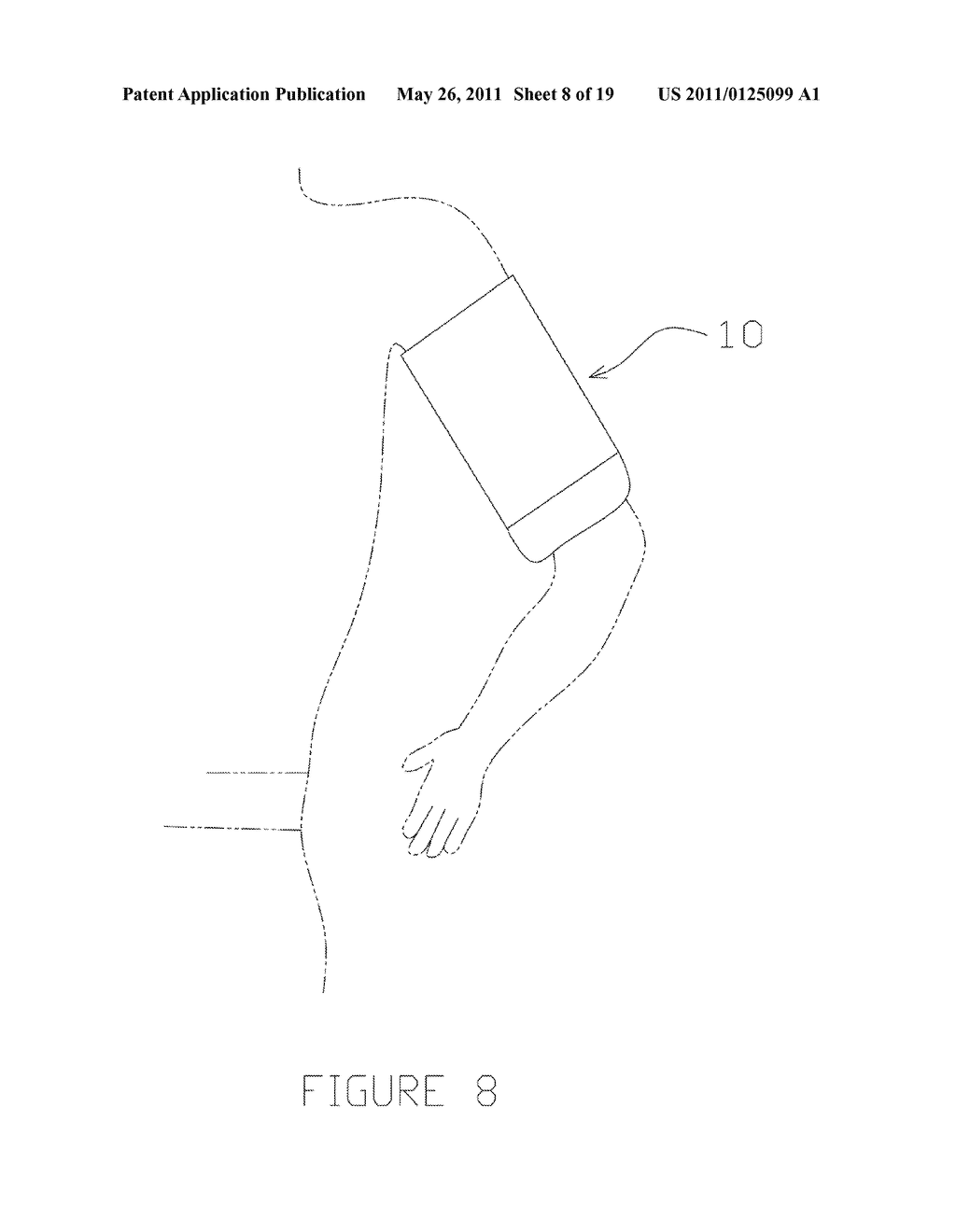 Protective Device for An Intravenous Catheter or Other Peripheral Body Penetrating Object - diagram, schematic, and image 09