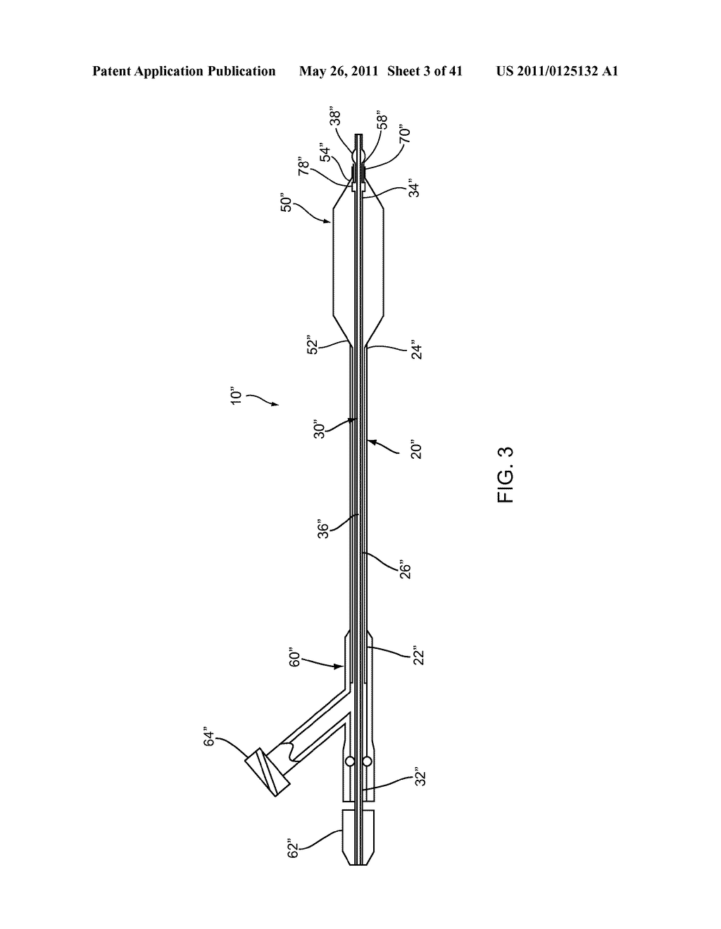 APPARATUS AND METHODS FOR TREATING OBSTRUCTIONS WITHIN BODY LUMENS - diagram, schematic, and image 04