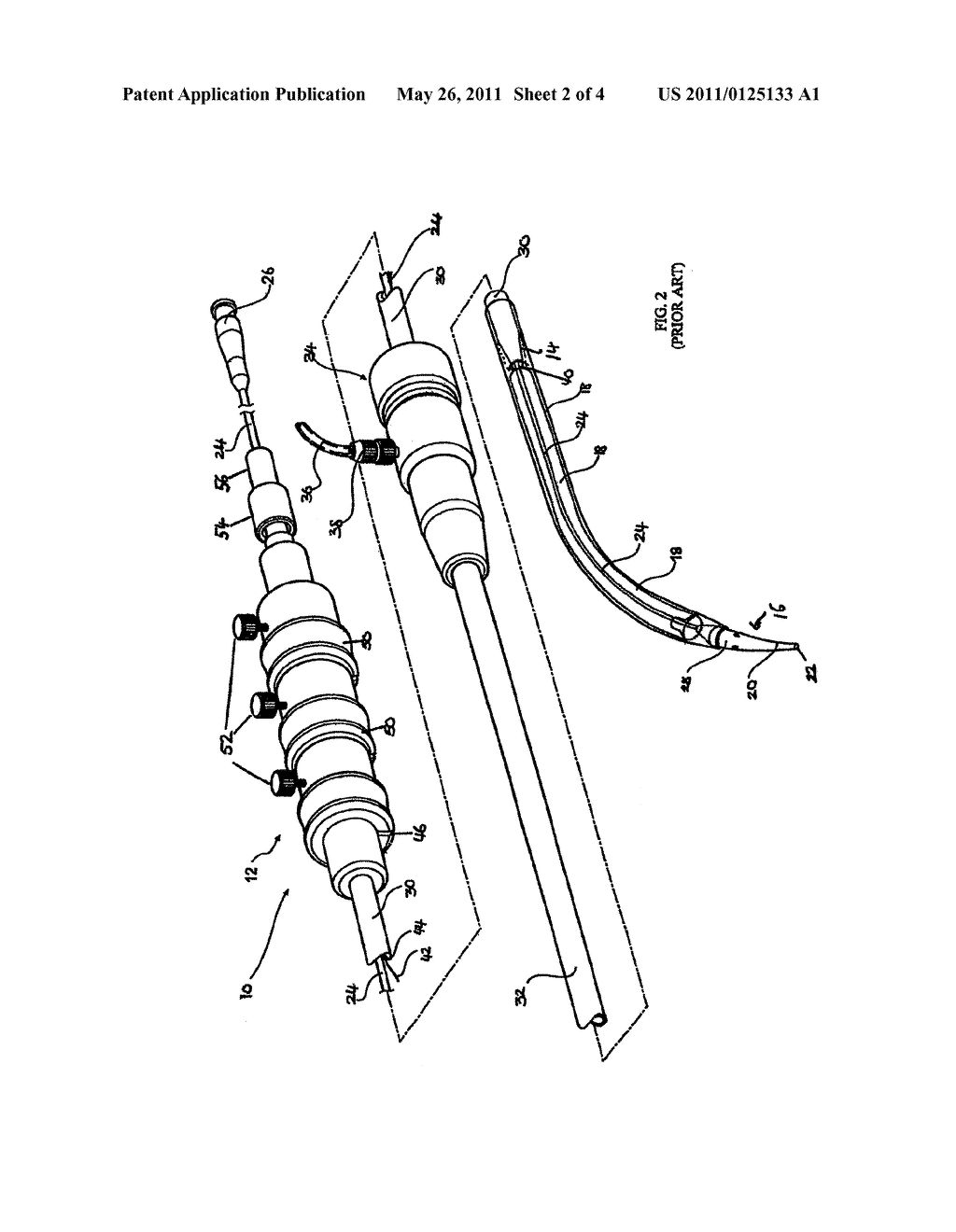 Catheter Components and Assembly - diagram, schematic, and image 03