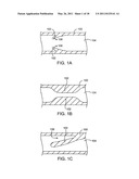 Cryotherapy Methods for Treating Vessel Dissections and Side Branch Occlusion diagram and image