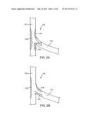 Cryotherapy Methods for Treating Vessel Dissections and Side Branch Occlusion diagram and image