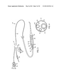 Cryotherapy Methods for Treating Vessel Dissections and Side Branch Occlusion diagram and image