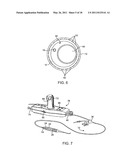 Cryotherapy Methods for Treating Vessel Dissections and Side Branch Occlusion diagram and image