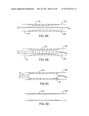 Cryotherapy Methods for Treating Vessel Dissections and Side Branch Occlusion diagram and image