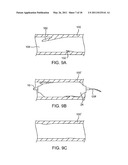 Cryotherapy Methods for Treating Vessel Dissections and Side Branch Occlusion diagram and image