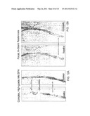 Cryotherapy Methods for Treating Vessel Dissections and Side Branch Occlusion diagram and image