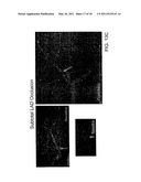 Cryotherapy Methods for Treating Vessel Dissections and Side Branch Occlusion diagram and image