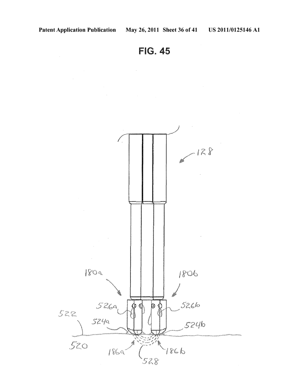 Cartridge Assembly For Electrosurgical Devices, Electrosurgical Unit And Methods Of Use Thereof - diagram, schematic, and image 37