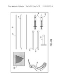 METHOD FOR TREATING JOINT PAIN AND ASSOCIATED INSTRUMENTS diagram and image