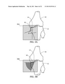 METHOD FOR TREATING JOINT PAIN AND ASSOCIATED INSTRUMENTS diagram and image