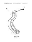 METHOD FOR TREATING JOINT PAIN AND ASSOCIATED INSTRUMENTS diagram and image